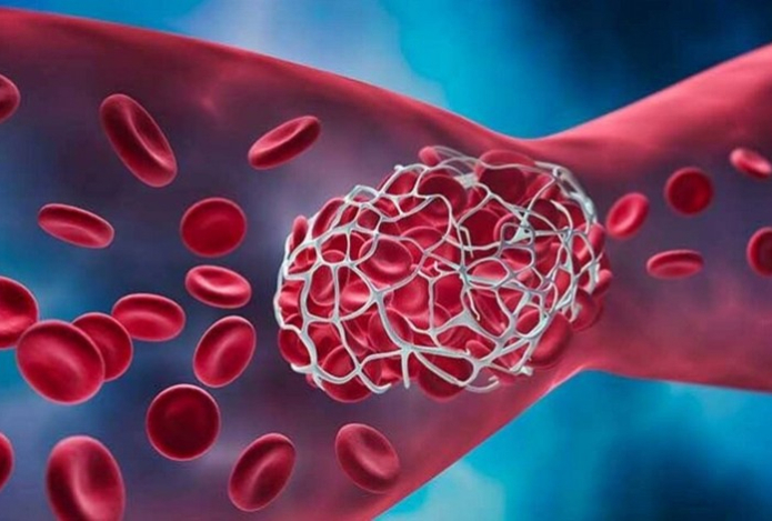 Врачи назвали три продукта против густой крови — они очистят организм от шлаков и токсинов