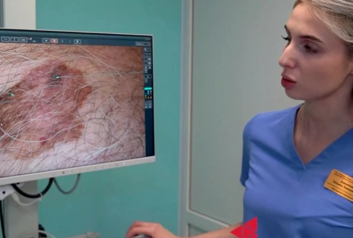 Онкологи объяснили, чем раковая родинка отличается от обычной — разница видна с первого взгляда