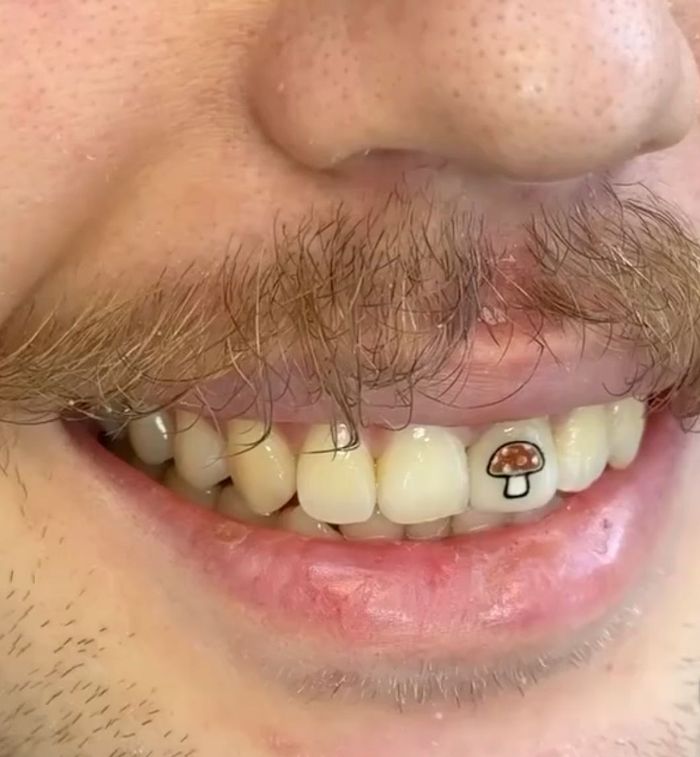 Татуировки на зубах становятся новым трендом в Сети. Фото