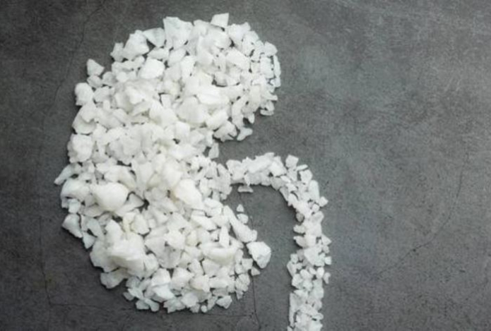 Опасный соблазн быстрых диет. Врач предупредил о камнях в желчном пузыре