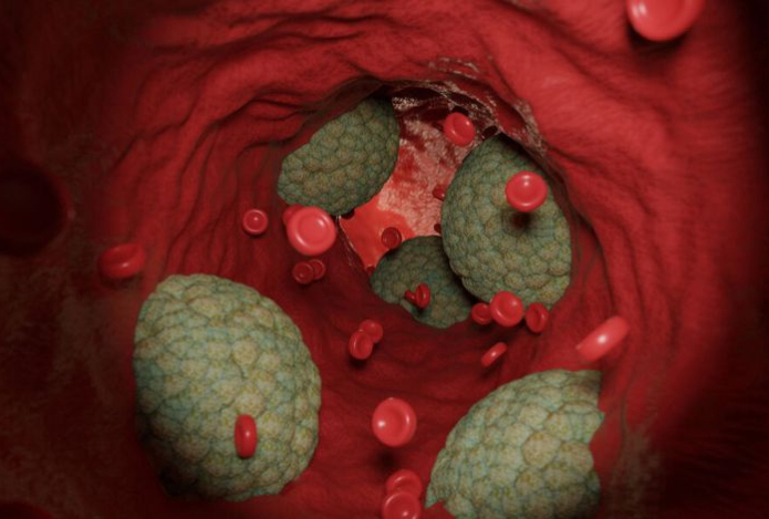 Назван неожиданный фактор повреждения артерий