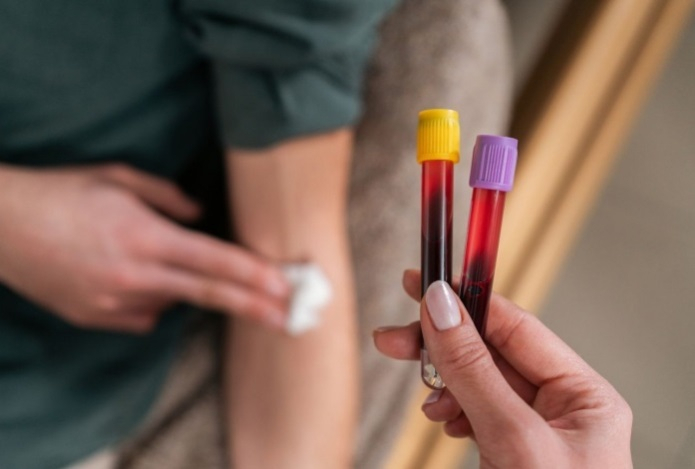 Как правильно сдавать анализов крови