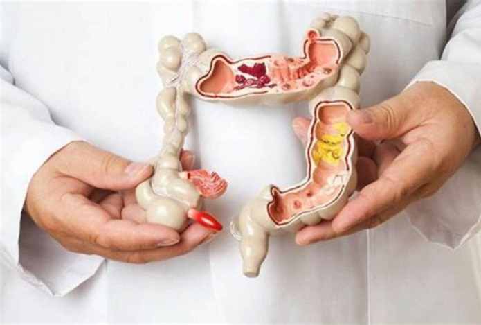 Названы не связанные с питанием причины сильного метеоризма
