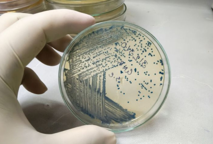 Ученые нашли неожиданное применение кишечной палочке