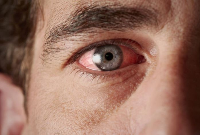 Врач объяснил, почему у пожилых слезятся глаза