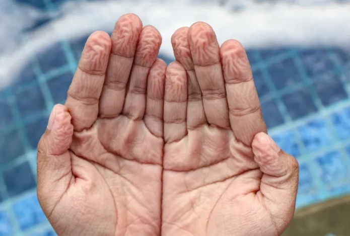 Оказывается, ученые не знают наверняка, почему кожа морщится после воды