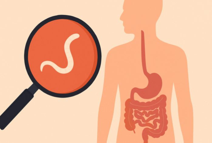 Названы главные симптомы, по которым можно заподозрить паразитов