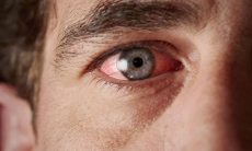 Дефицит каких питательных веществ сложнее всего распознать