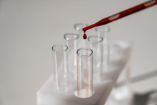 Общий анализ крови может выявить скрытый риск заболевания костей