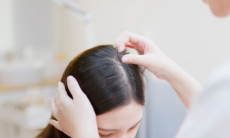 Врач назвал причины алопеции у женщин