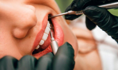 Врач развеял миф о том, что полный покой помогает зубному импланту прижиться