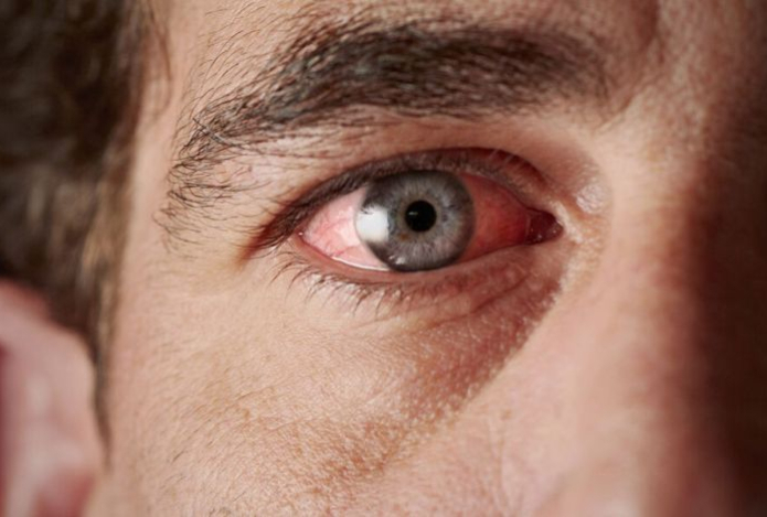 Дефицит каких питательных веществ сложнее всего распознать