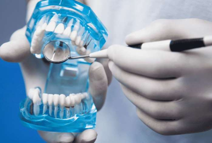 Стоматолог объяснил, могут ли импланты увеличить риск рака