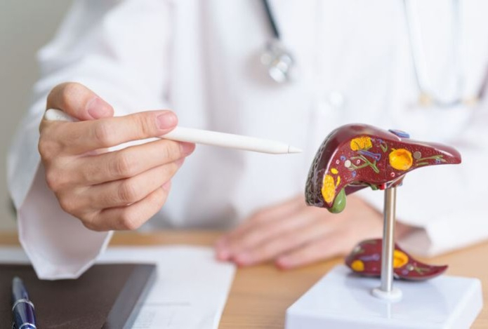 Нужно ли гнать желчь