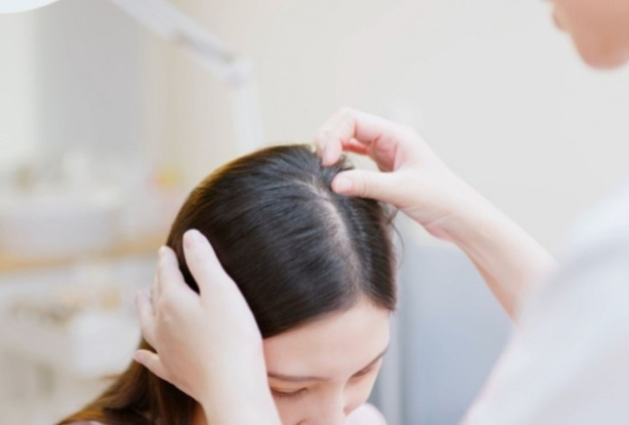 Врач назвал причины алопеции у женщин