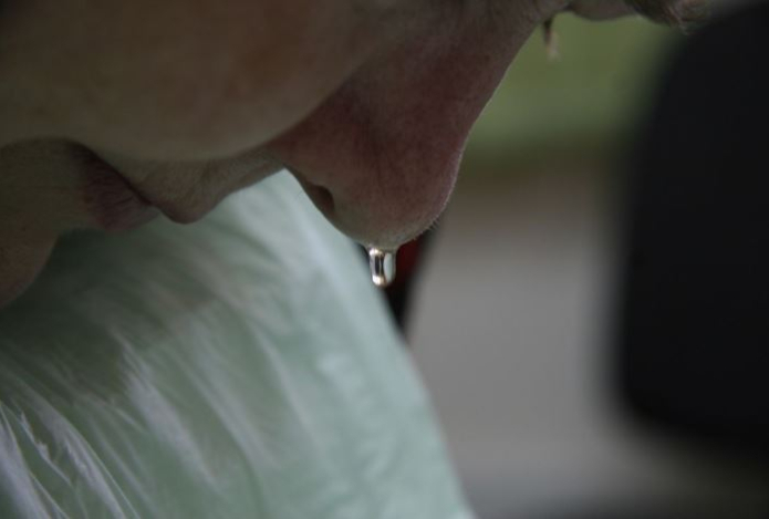 Почему на улице течёт из носа — и нужно ли это лечить