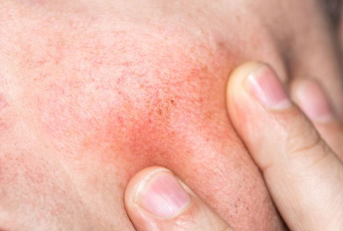 Как зимой ухаживать за кожей после 50 лет