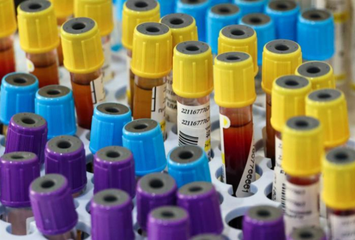 Врач раскрыла, влияет ли курение на результаты анализа крови на сахар