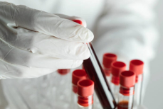 Как правильно читать анализы с учётом возраста