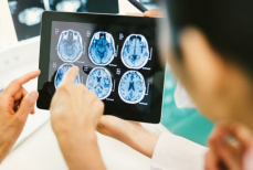 Обнаружена новая связь между диабетом и болезнью Альцгеймера