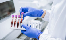 Найден новый способ выявить болезнь Альцгеймера до появления симптомов