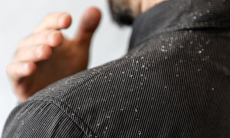 Врач предупредила, что промывание волос коньяком не помогает от перхоти