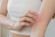 Почему на морозе появляется зуд и высыпания