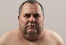 Врач предупредил о серьёзных рисках ожирения для внутренних органов