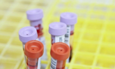 Что означает повышенный креатинин?