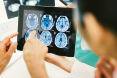 Ученые спрогнозировали рост заболеваемости деменцией к 2050 году