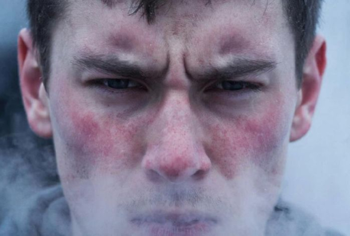 Почему мороз повышает риск инфаркта