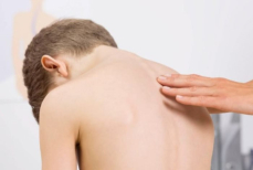 Сколиоз у детей не всегда заметен — врач объяснила, на что обратить внимание