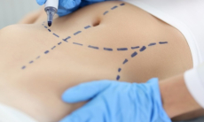 Какие операции специалист считает неоправданными