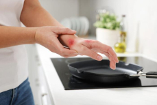 Ожог раскалённым маслом — фельдшер объяснила, что делать в первые минуты