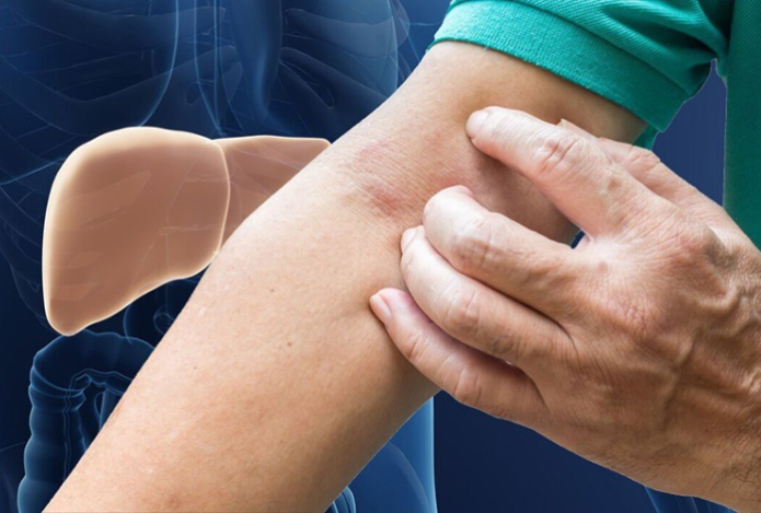 Назван неочевидный симптом проблем с печенью и почками