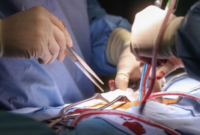 Стало известно, могут ли пересадить печень пациенту с циррозом