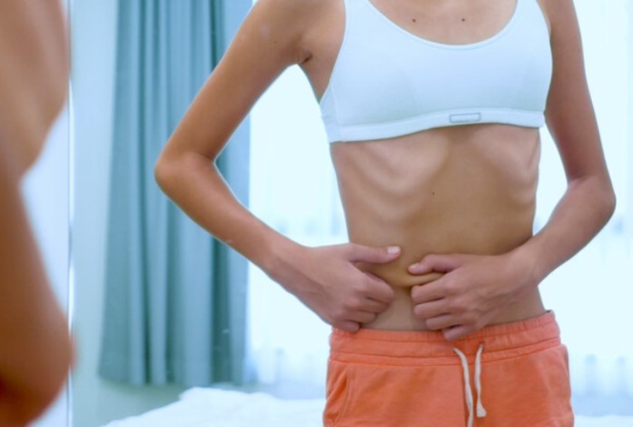 Врач рассказал, как распознать анорексию у близкого