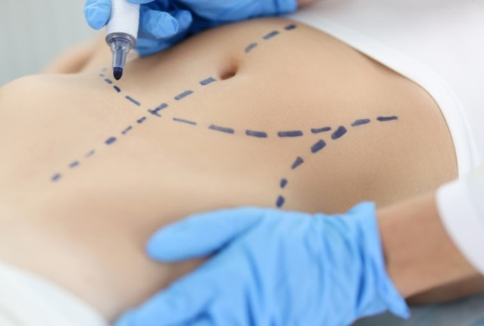 Какие операции специалист считает неоправданными