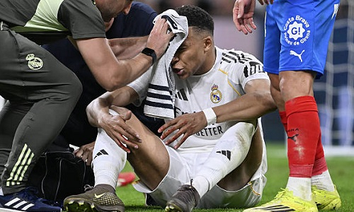 Килиан Мбаппе показал разбитое лицо перед матчем с «Баварией»